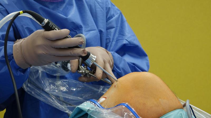 ACL Tears & Meniscal Injuries: Precision Reconstruction vs. Preservation — Surgical Decision-Making in 2026